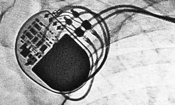 激光焊接在醫(yī)療行業(yè)技術(shù)中的應用